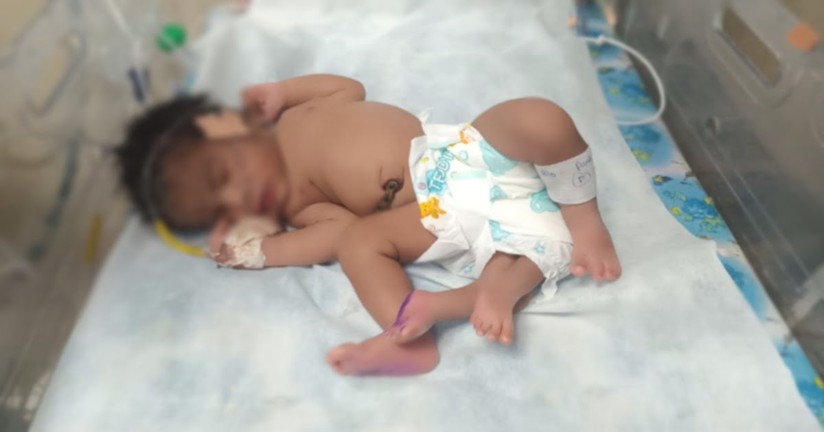 महिला ने चार पैरों वाली बच्ची को दिया जन्म, सोशल मीडिया में तस्वीर हो रही वायरल