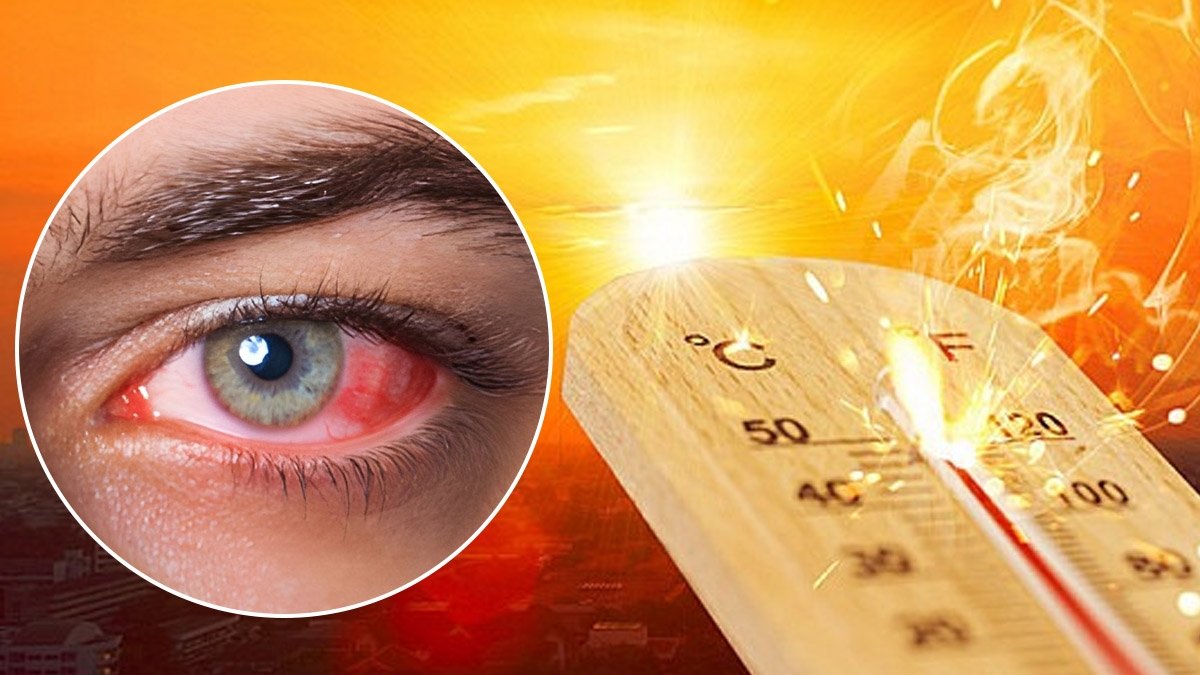 गर्मी में तेजी से बढ़ रहे ‘EYE STROKE ‘के मामले! जानिए लू के दौरान कैसे रखें अपनी आंखों का ख्याल