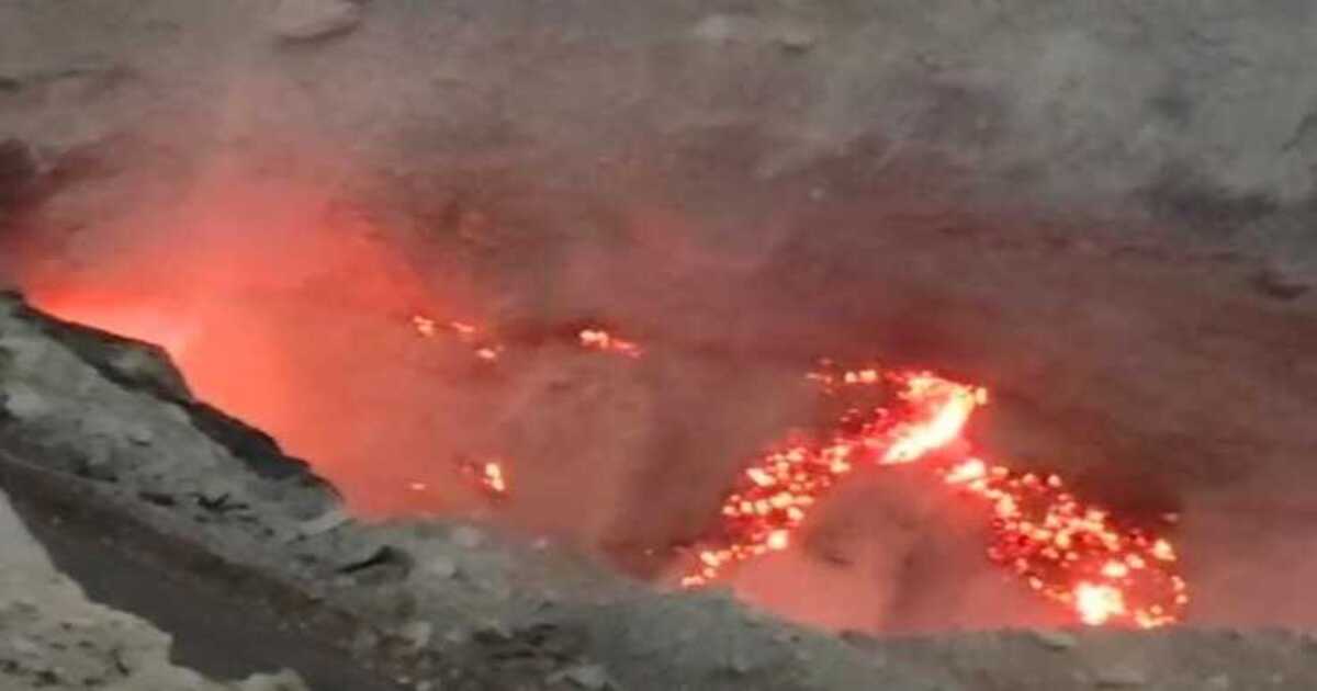 ज्वालामुखी बनी कोल नगरी, आग उगल रही खदानें… दोहरी मुसीबत में यहां के लोग