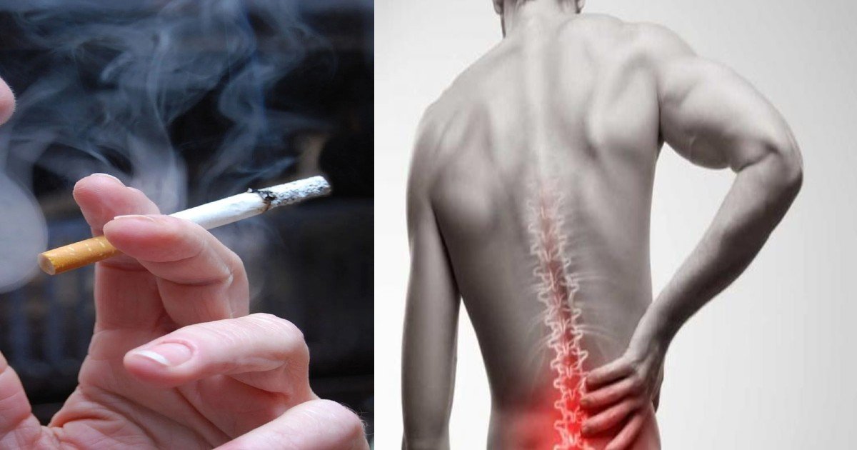 स्मोकिंग करने वाले हो जाएं सावधान! बढ़ता है स्लिप डिस्क का खतरा, रीढ़ की हड्डी हो रही कमजोर, डॉक्टरों ने दी चेतावनी